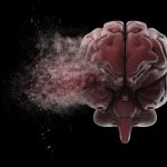 How Art and Color Aid Brain Injury Recovery?